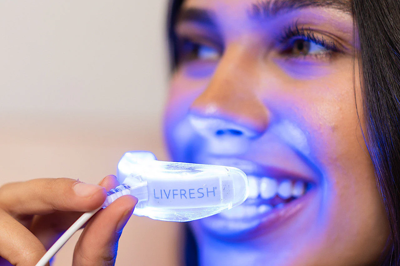 LIVFRESH Mobile Whitening System (Subscription) - Image 5